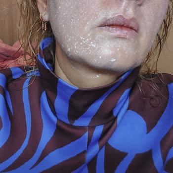 Procsin Sun Cream 50 Spf Sorunu