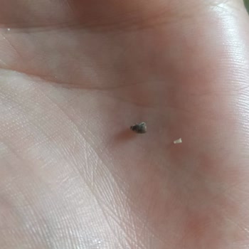 Anadolu Mutfağı Fasulyenin İçerisinde Böcek