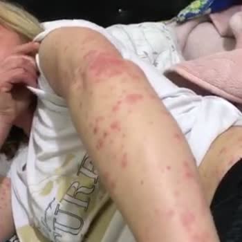 Dr. Doğu Yıldırım'a Sağlıklı Giden Hasta Çıkıyor