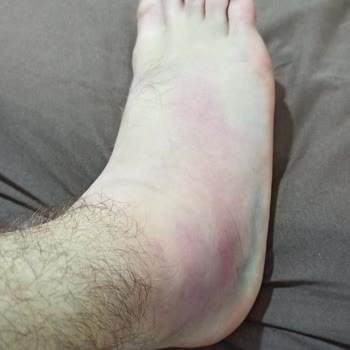 Kanuni Sultan Süleyman Eğitim Araştırma Hastanesi Doktor İlgisizliği Rapor Sıkıntısı