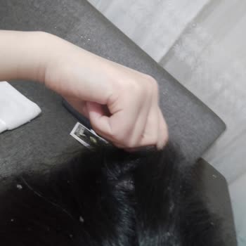 Gliss Saç Dökülmesi Ve Kepek