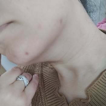 Sebamed Kompakt Celansıng Bar Cildimi Mahvetti