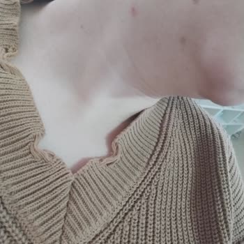 Sebamed Kompakt Celansıng Bar Cildimi Mahvetti