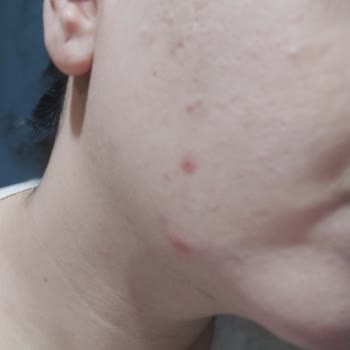 Sebamed Kompakt Celansıng Bar Cildimi Mahvetti