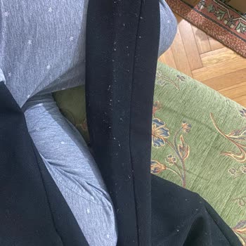 Pull & Bear Kaşe Kaban Pilling Sorunu