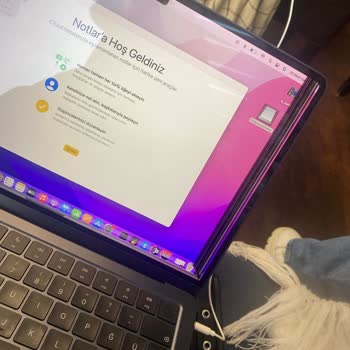 Teknosa Hasarlı Ürün Satıyor