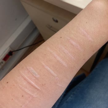 Özel Ekol International Tıp Merkezi Fraksiyonel Lazer Mağduriyeti