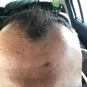 8 Eylül Hastanesi Genel Cerrah Uygulama Hatası Ve Hastane Sorumsuzluğu