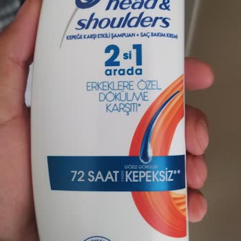 Head&Shoulders Kullandıktan Sonra Saçlarımın Dökülmesi Arttı