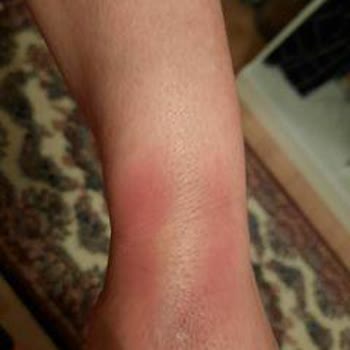 İmperial Hastanesi Acil Hemşirelerinin Bilgisizliği