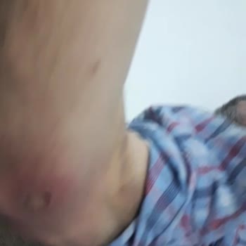 Medifema Hastanesi Yoğun Bakım Şikayeti