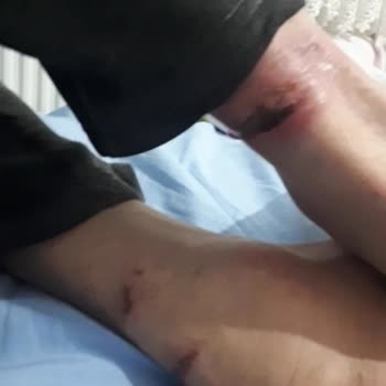 Medifema Hastanesi Yoğun Bakım Şikayeti