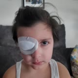 İzmir Özel Can Hastanesi Ameliyat Sırasında Göze Hasar Verme