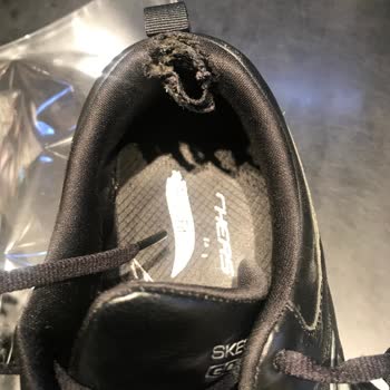My Skechers Shoes Became Useless in 2 Months