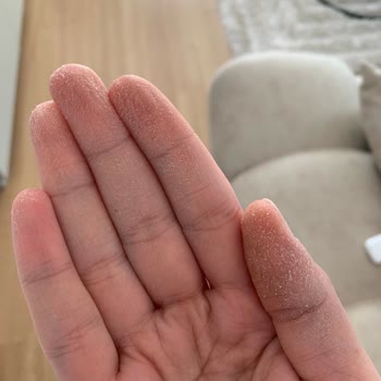 Medicana Hospitals Dr. Yanlış İlaç Verdi Telafisi İçin Para İstedi