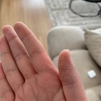 Medicana Hospitals Dr. Yanlış İlaç Verdi Telafisi İçin Para İstedi