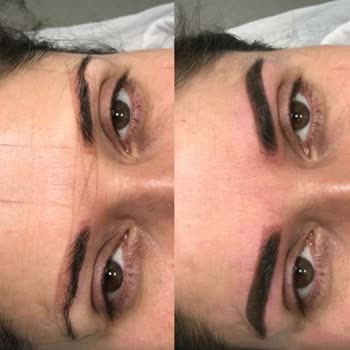 Estemol Estetik ve Güzellik Estemol Kurtköy Kaş