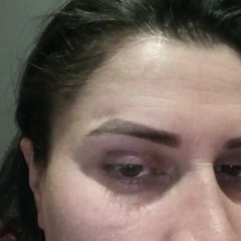 Estemol Estetik ve Güzellik Estemol Kurtköy Kaş