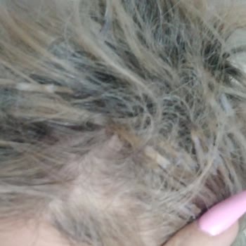 Engin Yücel Saç Tasarım İnsanları Yanıltıyor