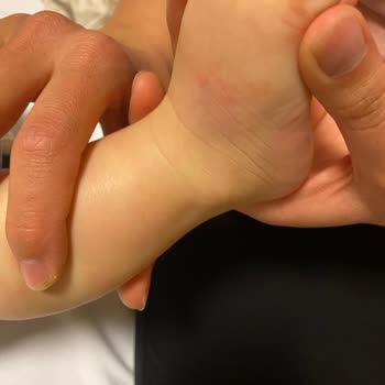 Yaşam Hastanesi (Antalya) Kötü Davrandı Bebeğim Daha Da Kötü Oldu