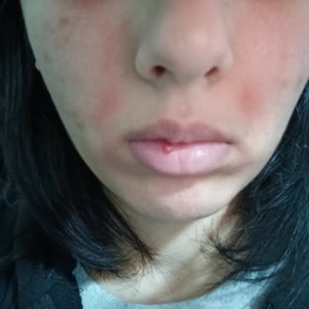 La Roche - Posay Cildimi Kuruttu