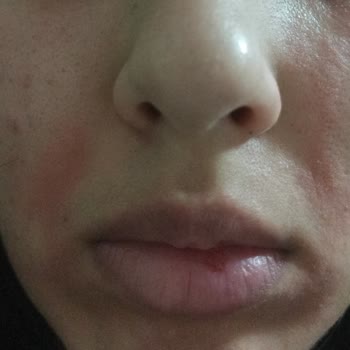 La Roche - Posay Cildimi Kuruttu