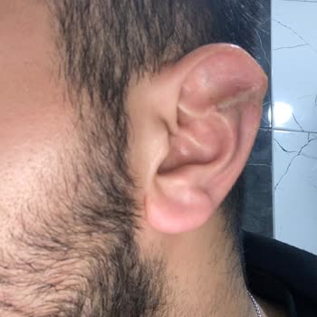 Özel Başarı Hastanesi Dr. Ahmet Bulut Estetik Ameliyatı