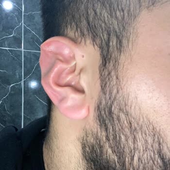 Özel Başarı Hastanesi Dr. Ahmet Bulut Estetik Ameliyatı