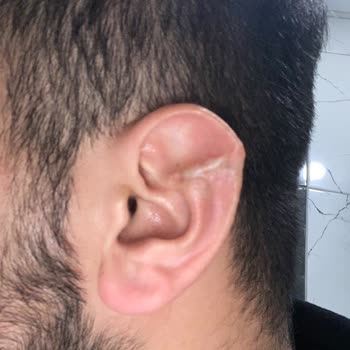 Özel Başarı Hastanesi Dr. Ahmet Bulut Estetik Ameliyatı