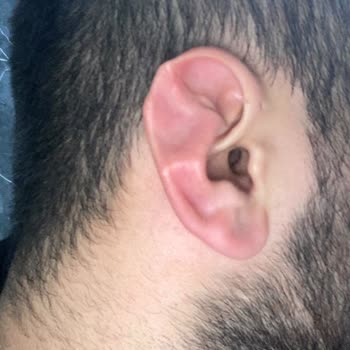 Özel Başarı Hastanesi Dr. Ahmet Bulut Estetik Ameliyatı