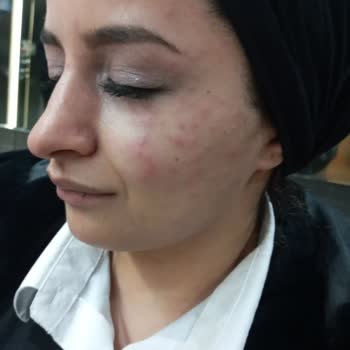 Rise & Shine Alovera Beyazlatıcı Krem