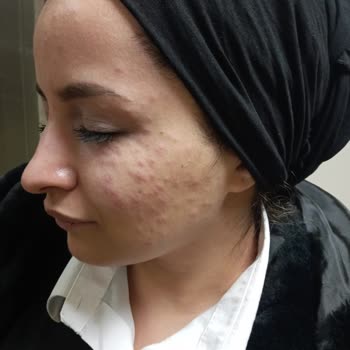 Rise & Shine Alovera Beyazlatıcı Krem