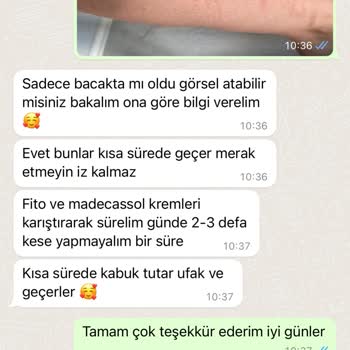 Sevlife Güzellik Merkezi Sevlife Güzellik Geçmeyen Lazer Yanığı