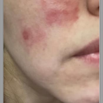 Bahar Babacan Skin Care Ürünleri Tam Bir Hayal Kırıklığıdır