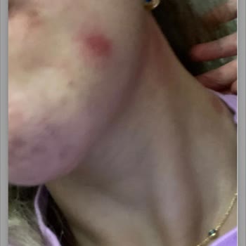 Bahar Babacan Skin Care Ürünleri Tam Bir Hayal Kırıklığıdır