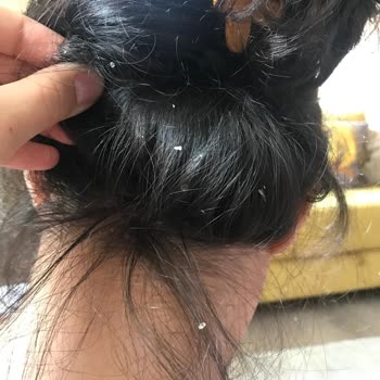 W-LAB Cosmetics Egzama Sorunum Baş Edilmez Hale Geldi