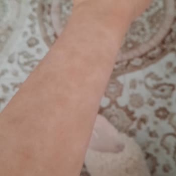 Abdi İbrahim Factive İlacı Yan Etkisi Hayatımı Mahvetti!