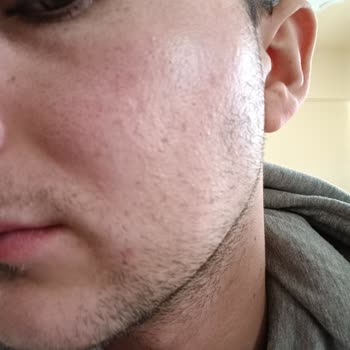 Bioderma Sensibio Ar Ürün Memnuniyetsizliği