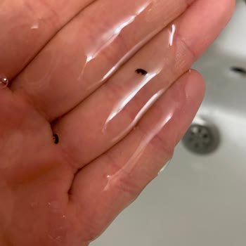 Dalin Bebek Şampuanından Böcek Çıktı