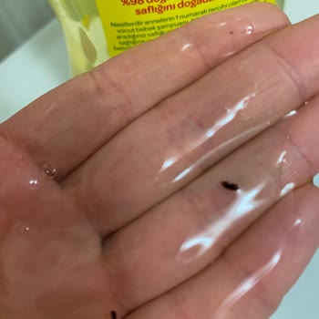 Dalin Bebek Şampuanından Böcek Çıktı