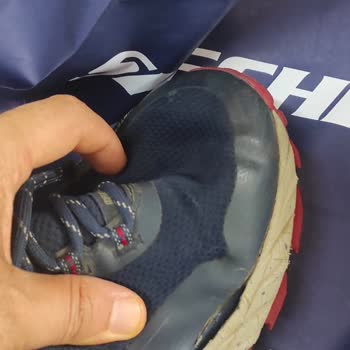 Skechers Ayakkabı Garanti Fiyaskosu