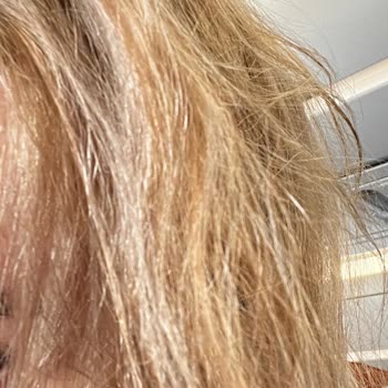 The Hair Lab İstanbul Saçlarımı Yaktı