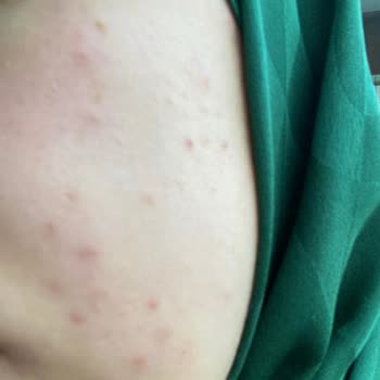 Cerave Nemlendirici Krem Hüsranı