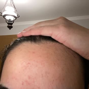 Watsons Çalışanların Ürünü Alın Diye Diretmesi, Ürün İçeriği