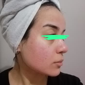 She Vec Cosmetic Red Of Love Kırmızı Peeling Serumu