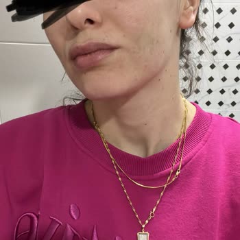 Dentacenter Röntgensiz Diş Çekimi Sıkıntısı !