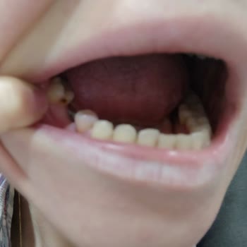 Çekmeköy Ağız Ve Diş Sağlığı Merkezi'nde Yaşanan Sorunlar!