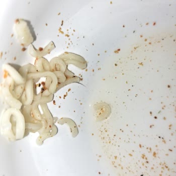 A101 Banetti Noodle'nin İçinden Kıl Çıktı!