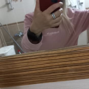 İzmir Gaziemir Orçin Kuaför'ün Saçımı Yakıp Saç Kaybına Uğratması