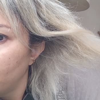 İzmir Gaziemir Orçin Kuaför'ün Saçımı Yakıp Saç Kaybına Uğratması